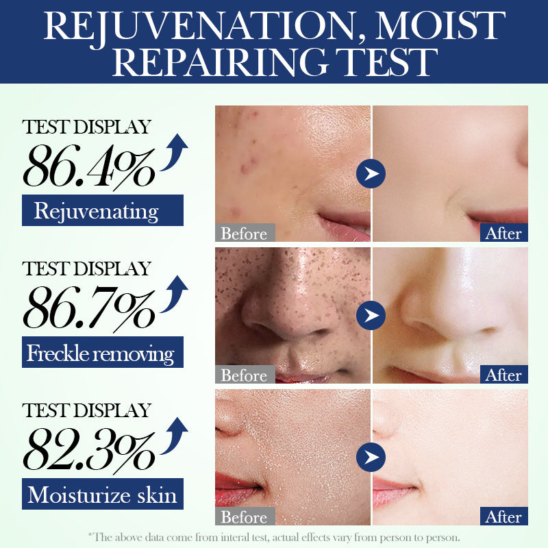 đ„Last Day Promotion 60%Off Korean Skincare Coffee&Green Tea Essential Mask